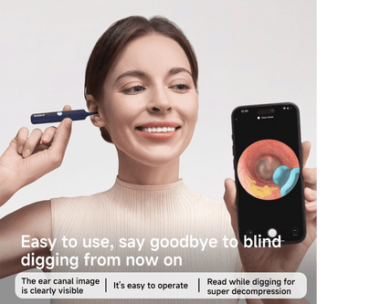 BEBIRD Advanced Ear Cleaning Device with HD Camera, 10MP Endoscope, Safe Tweezers, 11 Ear Scoops, Full ENT Observation Tools for Ear, Nose & Throat, Kids & Adults, Portable with Storage Case