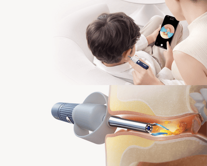 BEBIRD Advanced Ear Cleaning Device with HD Camera, 10MP Endoscope, Safe Tweezers, 11 Ear Scoops, Full ENT Observation Tools for Ear, Nose & Throat, Kids & Adults, Portable with Storage Case